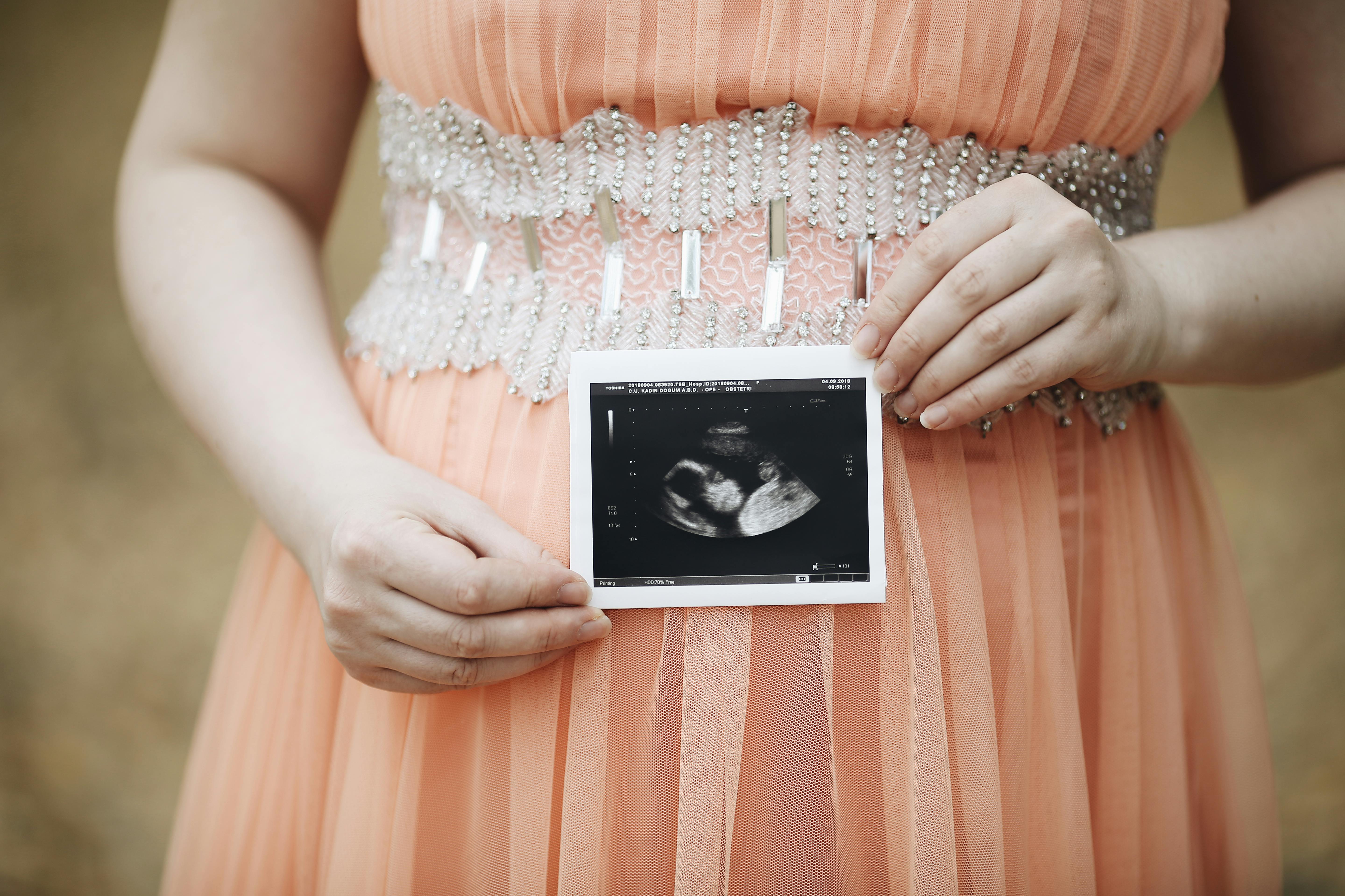 Ultrasound